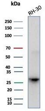 Carbonic Anhydrase 3/CA3 Antibody in Western Blot (WB)