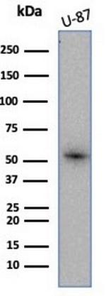 Renal Cell Carcinoma (Carbonic Anhydrase IX) Antibody in Western Blot (WB)