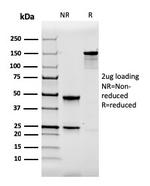 Calbindin 1 (CALB1) Antibody in SDS-PAGE (SDS-PAGE)