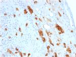 Calretinin/Calbindin 2 (Mesothelioma Marker) Antibody in Immunohistochemistry (Paraffin) (IHC (P))