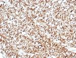 Calretinin/Calbindin 2 (Mesothelioma Marker) Antibody in Immunohistochemistry (Paraffin) (IHC (P))