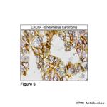 CXCR4, CXC Chemokine Receptor 4 Antibody in Immunohistochemistry (PFA fixed) (IHC (PFA))