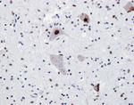 TDP-43 Antibody in Immunohistochemistry (IHC)