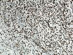 TDP-43 Antibody in Immunohistochemistry (Paraffin) (IHC (P))