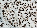 TDP-43 Antibody in Immunohistochemistry (Paraffin) (IHC (P))