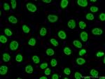 TDP-43 Antibody in Immunocytochemistry (ICC/IF)