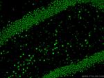 TDP-43 Antibody in Immunohistochemistry (Paraffin) (IHC (P))