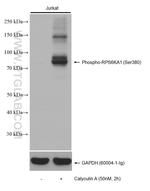 Phospho-RPS6KA1 (Ser380) Antibody in Western Blot (WB)