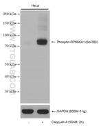 Phospho-RPS6KA1 (Ser380) Antibody in Western Blot (WB)