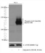 Phospho-ULK1 (Ser556) Antibody in Western Blot (WB)
