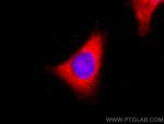 GAPDH Antibody in Immunocytochemistry (ICC/IF)