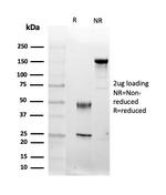 FGF23 (Fibroblast Growth Factor 23) Antibody in SDS-PAGE (SDS-PAGE)