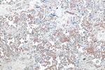 Band 3/AE1 Antibody in Immunohistochemistry (Paraffin) (IHC (P))