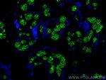 Band 3/AE1 Antibody in Immunohistochemistry (PFA fixed) (IHC (PFA))