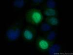 UBE2S Antibody in Immunocytochemistry (ICC/IF)
