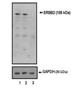 ErbB2 (HER-2) Antibody in Western Blot (WB)