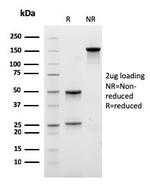 Eosinophil Peroxidase (EPX) Antibody in SDS-PAGE (SDS-PAGE)