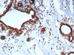 BAP1 (BRCA1 Associated Protein 1) Antibody in Immunohistochemistry (Paraffin) (IHC (P))