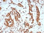 BAP1 (BRCA1 Associated Protein 1) Antibody in Immunohistochemistry (Paraffin) (IHC (P))