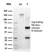 CBFB/PEBP2beta Antibody in SDS-PAGE (SDS-PAGE)