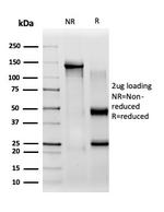 CBFB/PEBP2beta Antibody in SDS-PAGE (SDS-PAGE)