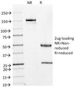 Cyclin A2 (S- and G2-phase Cyclin) Antibody in SDS-PAGE (SDS-PAGE)