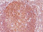 BCL10 (MALT-Lymphoma Marker) Antibody in Immunohistochemistry (Paraffin) (IHC (P))