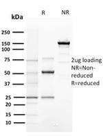 Cyclin E (G1/S-Phase Cyclin) Antibody in SDS-PAGE (SDS-PAGE)
