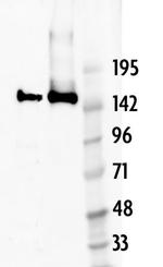 Cas9 Antibody in Western Blot (WB)