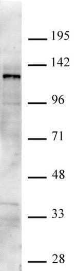 JMJD2C/KDM4C Antibody in Western Blot (WB)