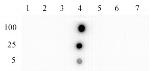 JMJD2D/KDM4D Antibody in Dot Blot (DB)