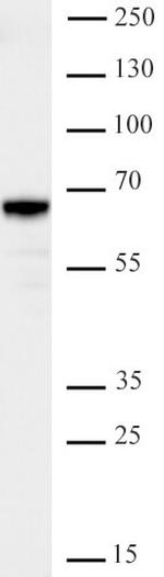 JMJD2D/KDM4D Antibody in Western Blot (WB)