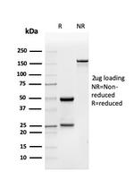 BMP15/GDF9B Antibody in SDS-PAGE (SDS-PAGE)