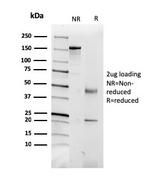 CD5L/CD5LG/CD5 Ligand Antibody in SDS-PAGE (SDS-PAGE)