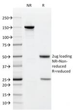 CD9 (TSPAN29) (Motility-Related Protein-1) Antibody in SDS-PAGE (SDS-PAGE)