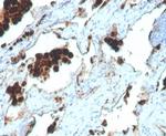 Napsin A (Lung Adenocarcinoma Marker) Antibody in Immunohistochemistry (Paraffin) (IHC (P))