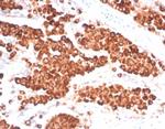 Napsin A (Lung Adenocarcinoma Marker) Antibody in Immunohistochemistry (Paraffin) (IHC (P))