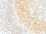 CD40/TNFRSF5/CD40L-Receptor Antibody in Immunohistochemistry (Paraffin) (IHC (P))