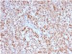 CD40 Ligand/CD154/TRAP1 (Activation Marker of T-Lymphocytes) Antibody in Immunohistochemistry (Paraffin) (IHC (P))