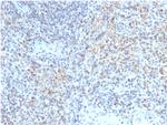 CD40 Ligand/CD154/TRAP1 (Activation Marker of T-Lymphocytes) Antibody in Immunohistochemistry (Paraffin) (IHC (P))