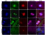 Rat IgG (H+L) Cross-Adsorbed Secondary Antibody in Immunocytochemistry (ICC/IF)