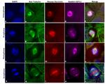 Rat IgG (H+L) Cross-Adsorbed Secondary Antibody in Immunocytochemistry (ICC/IF)