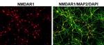 Mouse IgG (H+L) Highly Cross-Adsorbed Secondary Antibody in Immunocytochemistry (ICC/IF)