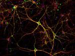 Mouse IgG (H+L) Highly Cross-Adsorbed Secondary Antibody in Immunocytochemistry (ICC/IF)