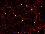 Rabbit IgG (H+L) Highly Cross-Adsorbed Secondary Antibody in Immunocytochemistry (ICC/IF)