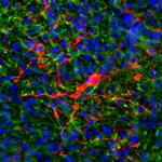 Rat IgG (H+L) Cross-Adsorbed Secondary Antibody in Immunohistochemistry (Frozen) (IHC (F))