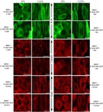 alpha Tubulin Antibody in Immunohistochemistry (IHC)