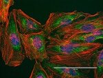 Mouse IgG (H+L) Highly Cross-Adsorbed Secondary Antibody in Immunocytochemistry (ICC/IF)