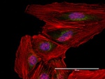 Mouse IgG (H+L) Highly Cross-Adsorbed Secondary Antibody in Immunocytochemistry (ICC/IF)