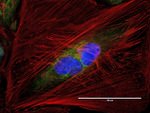 Mouse IgG (H+L) Highly Cross-Adsorbed Secondary Antibody in Immunocytochemistry (ICC/IF)